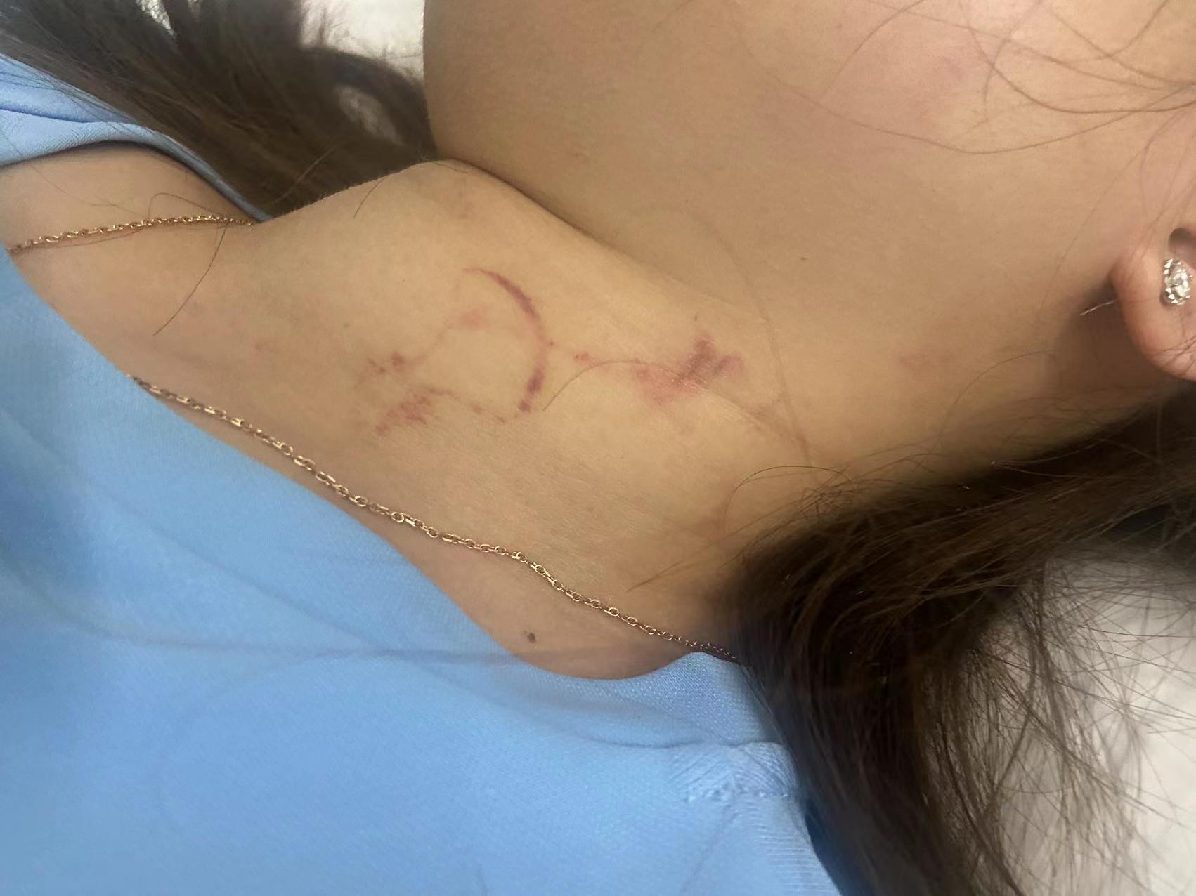 女子柬埔寨遭性侵后还要付小费.被威胁不翻供就报复