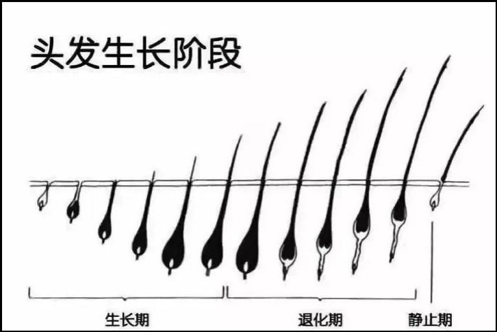 压力大了会脱发是真的.男人到中年导致大量掉头发的原因