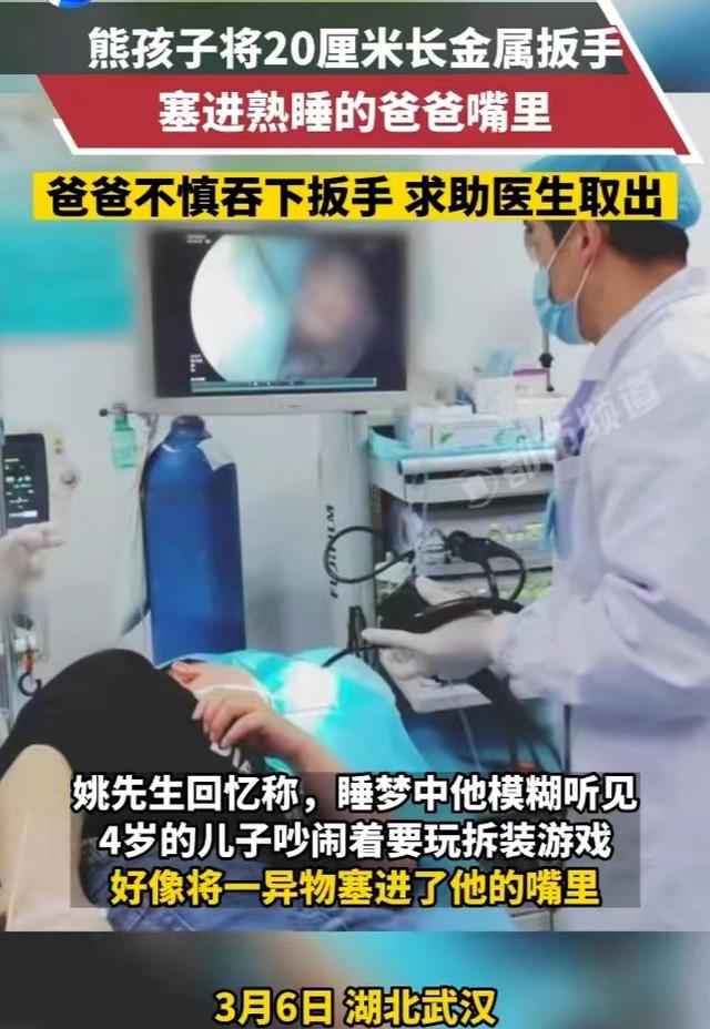 张嘴睡觉误吞20cm扳手尽不知道.